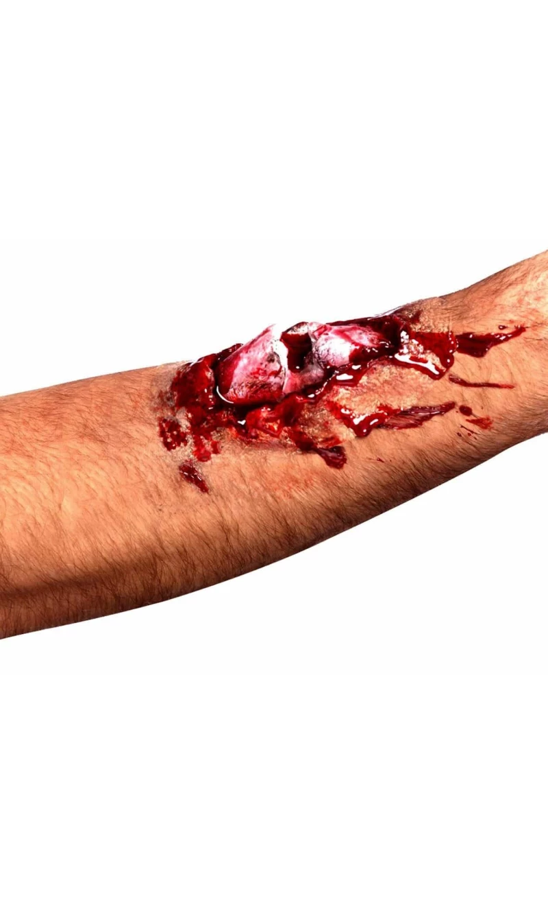 Latex Broken Bone Scar