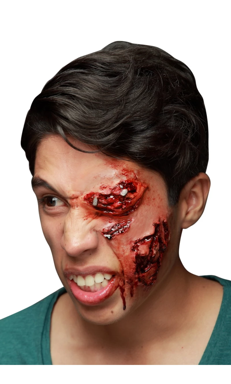 Infected Latex Scar